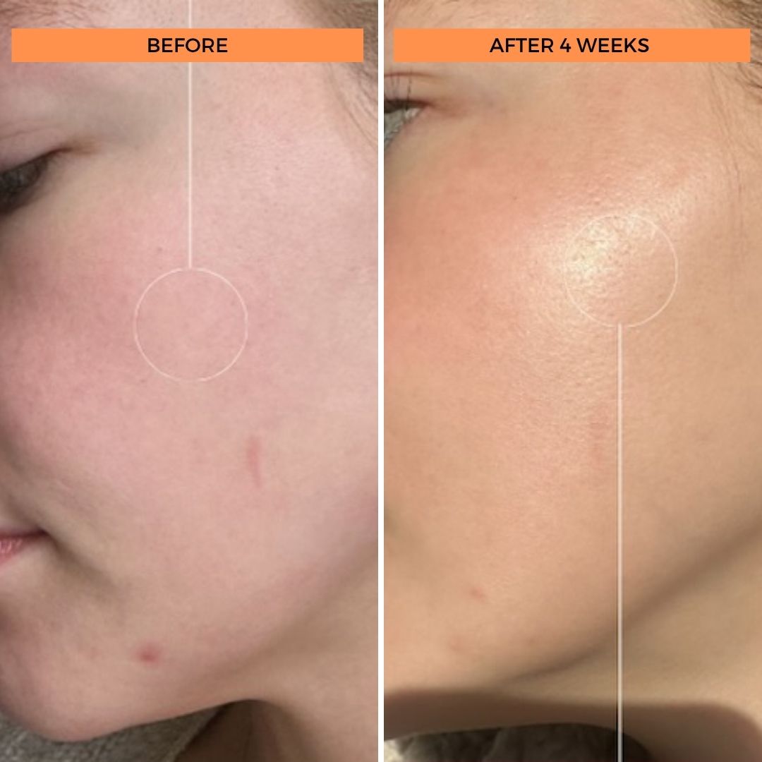 Universal C Skin Refiner 50ml